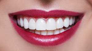 dịch vu trồng răng sứ tại phòng khám răng hàm mặt uy tín Nha Khoa MIC Thủ Đức