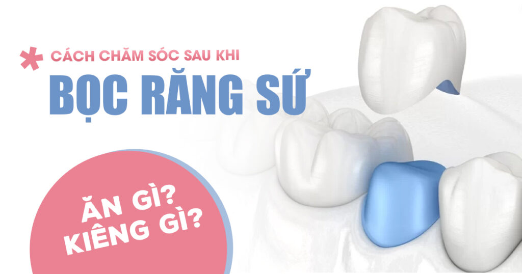 Cách Chăm Sóc Sau Khi Bọc Răng Sứ: Ăn Gì, Kiêng Gì?
