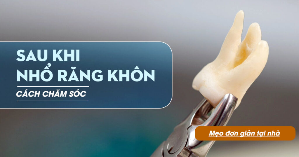 Cách Chăm Sóc Sau Khi Nhổ Răng Khôn – Mẹo Đơn Giản Tại Nhà
