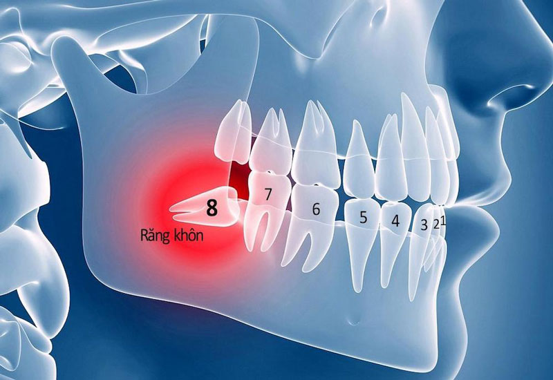 Ai Cũng Phải Mọc Răng Khôn Hay Sao? Sự Thật Ít Ai Ngờ Tới!