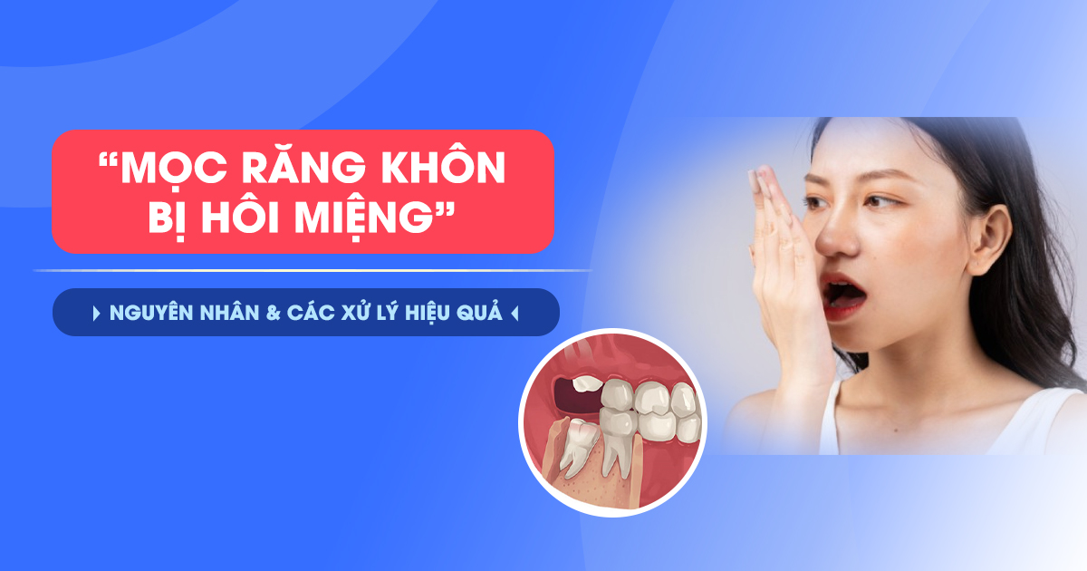 Mọc Răng Khôn Hôi Miệng: Nguyên Nhân và Cách Xử Lý Hiệu Quả