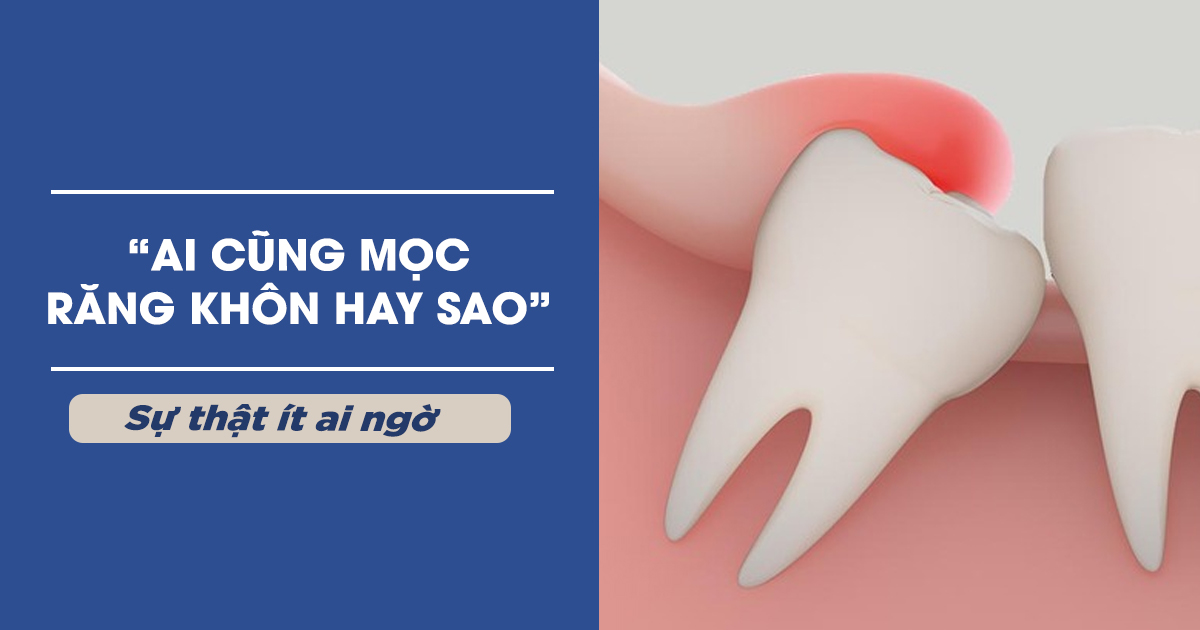 Ai Cũng Phải Mọc Răng Khôn Hay Sao? Sự Thật Ít Ai Ngờ Tới!