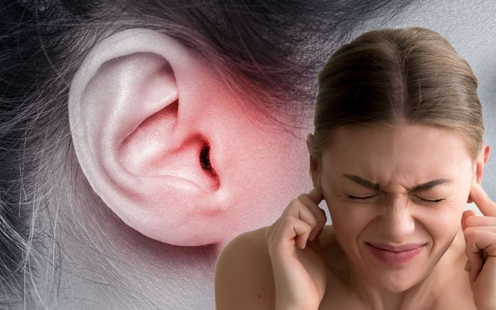 Mọc Răng Khôn Ù Tai: Dấu Hiệu Cảnh Báo Và Giải Pháp